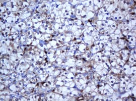 Selenium Binding Protein 1 Antibody (clone OTI3H1)