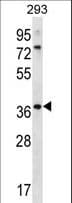 Polyclonal Rabbit anti-Human OR6X1 Antibody (aa276-305, WB)