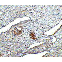 Polyclonal Rabbit anti-Human TMEM142A / ORAI1 Antibody (IHC, IF, WB)