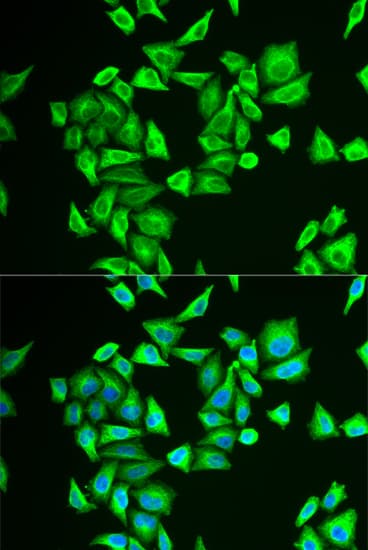 PGM1 / Phosphoglucomutase 1 Antibody