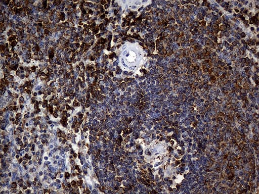 CRLF3 Antibody (clone OTI2A9)