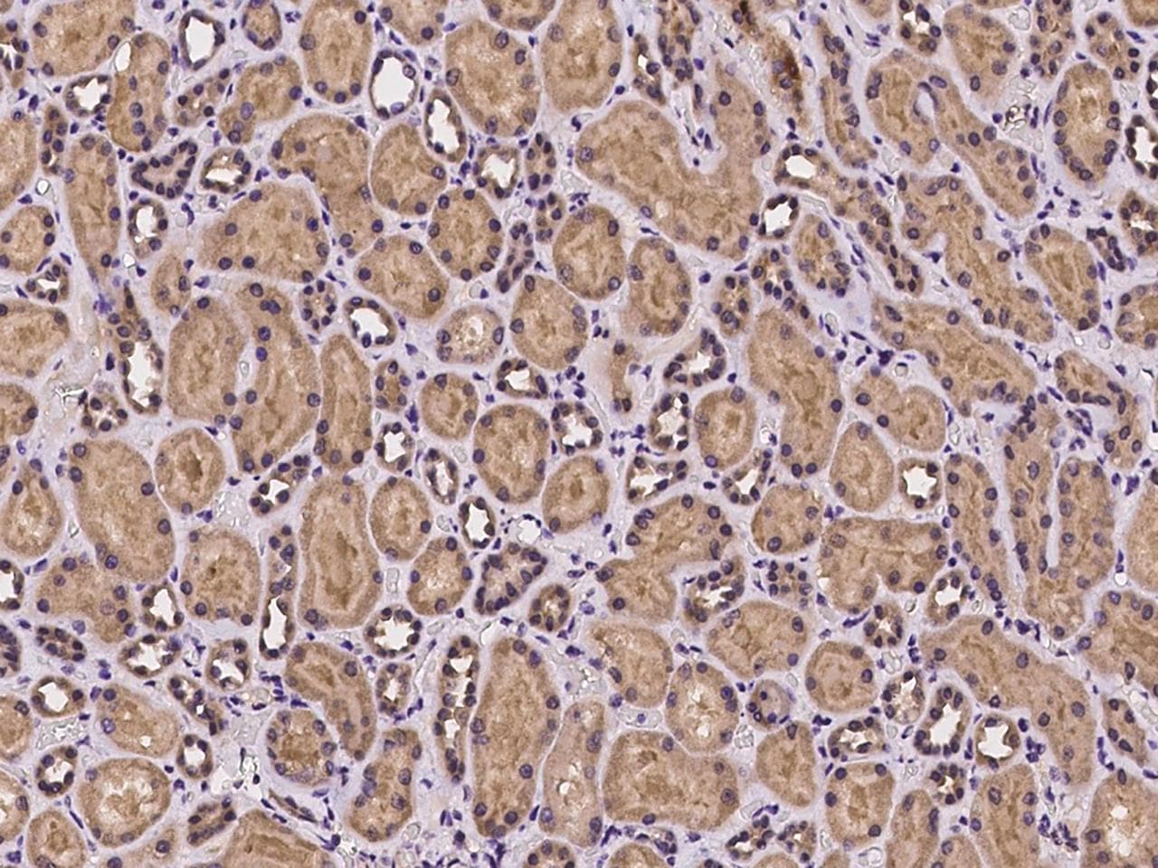 MUS81 Antibody