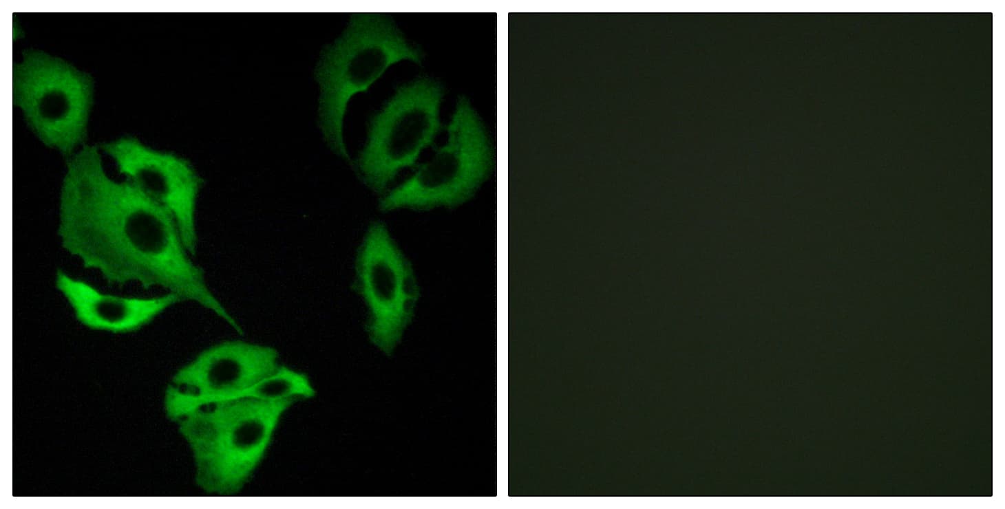 ADCK4 Antibody (aa31-80)