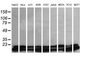 UBE2G2 Antibody (clone OTI4A12)
