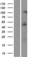 PRMT2 Protein (Over-Expression Lysate Myc-DDK (Flag))