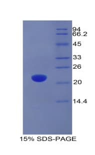 Rat ADM / Adrenomedullin Protein (Recombinant His)