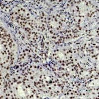 Monoclonal Mouse anti-Human HIST1H3H Antibody (IHC, WB)