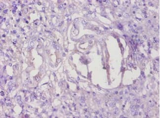 Polyclonal Rabbit anti-Human TMEM14B Antibody (aa1-114, WB)