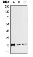Calcitonin Antibody (Internal)