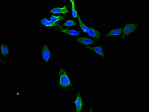 Polyclonal Rabbit anti-Human PTGR1 / LTB4DH Antibody (IHC, IF)