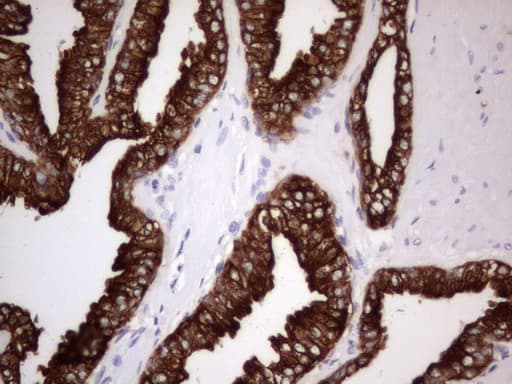 Monoclonal Rat anti-Human Acidic Cytokeratin Antibody (clone 2G10, IHC)