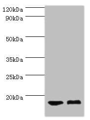CLP / COTL1 Antibody (aa1-142)