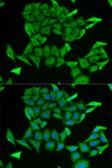 MB / Myoglobin Antibody