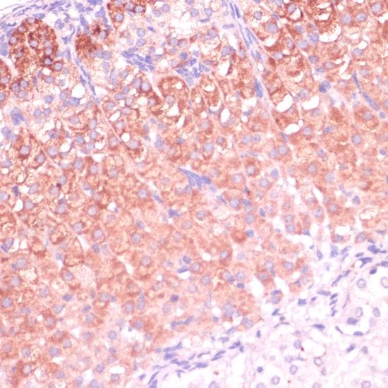 CYP11B2 / Aldosterone Synthase Antibody