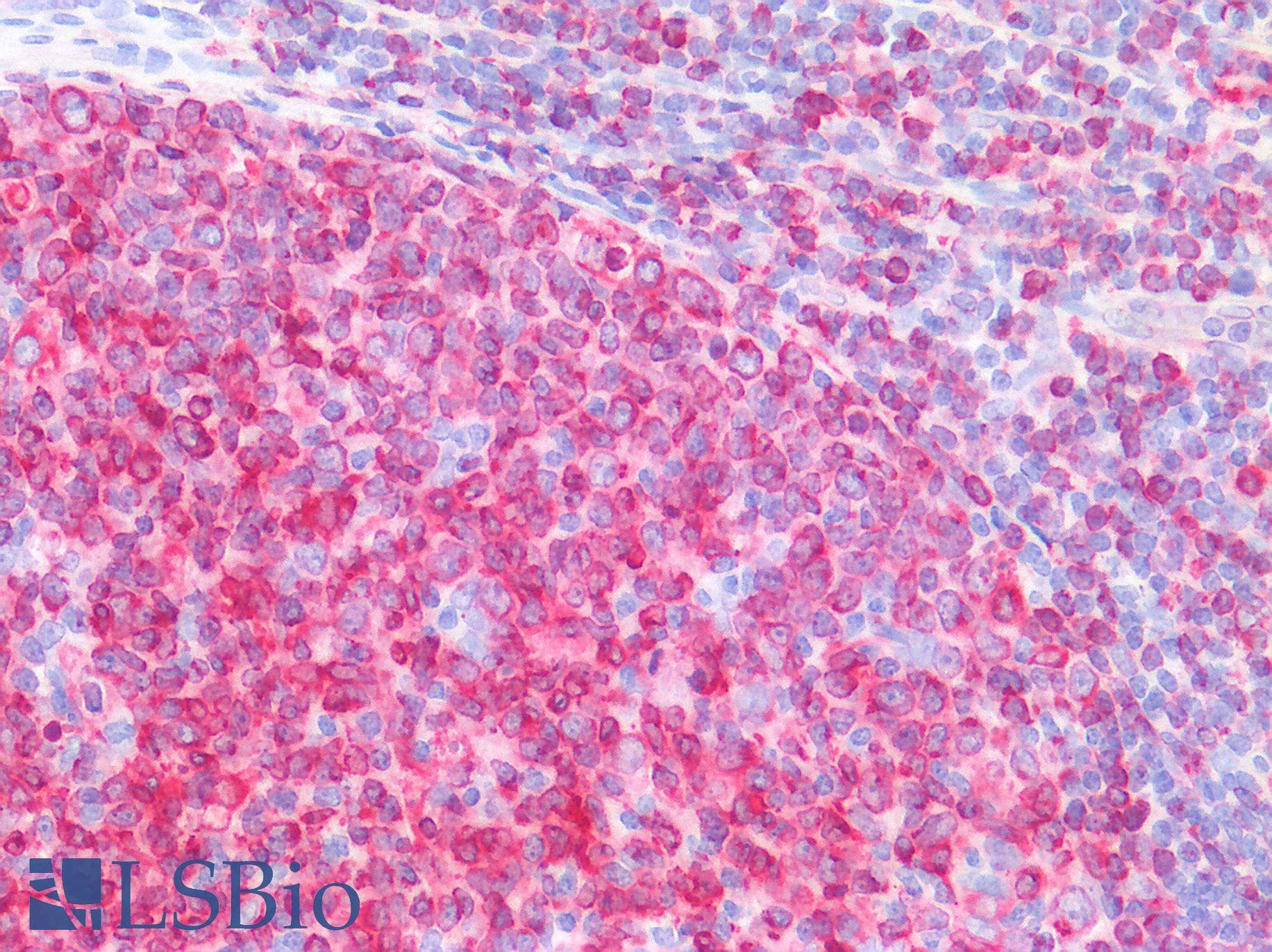 IHC-plus™ Polyclonal Goat anti-Human CD74 / CLIP Antibody (aa159-171, IHC, WB)