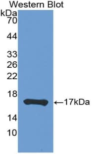 LTA / TNF Beta Antibody (aa53-172)