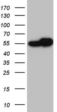 Monoclonal Mouse anti-Human RAD23B / HR23B Antibody (clone OTI12C10, aa1-253, WB)