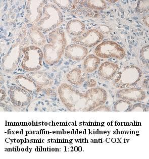 COXIV / COX4 Antibody (C-Terminus)