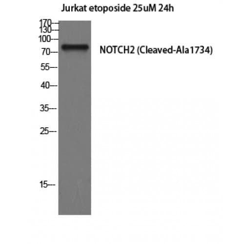 NOTCH2 Antibody (1690-1770 aa, Internal)