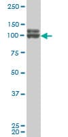 Monoclonal Mouse anti-Human DP97 / DDX54 Antibody (clone 2E4, IHC, WB)