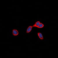 Polyclonal Rabbit anti-Human TNFRSF9 / 4-1BB / CD137 Antibody (aa89-118, IF, WB)