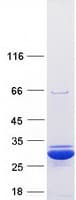 Human SOD2 / Mn SOD Protein (Recombinant Myc-DDK (Flag))