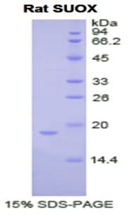 Rat SUOX / Sulfite Oxidase Protein (Recombinant His)
