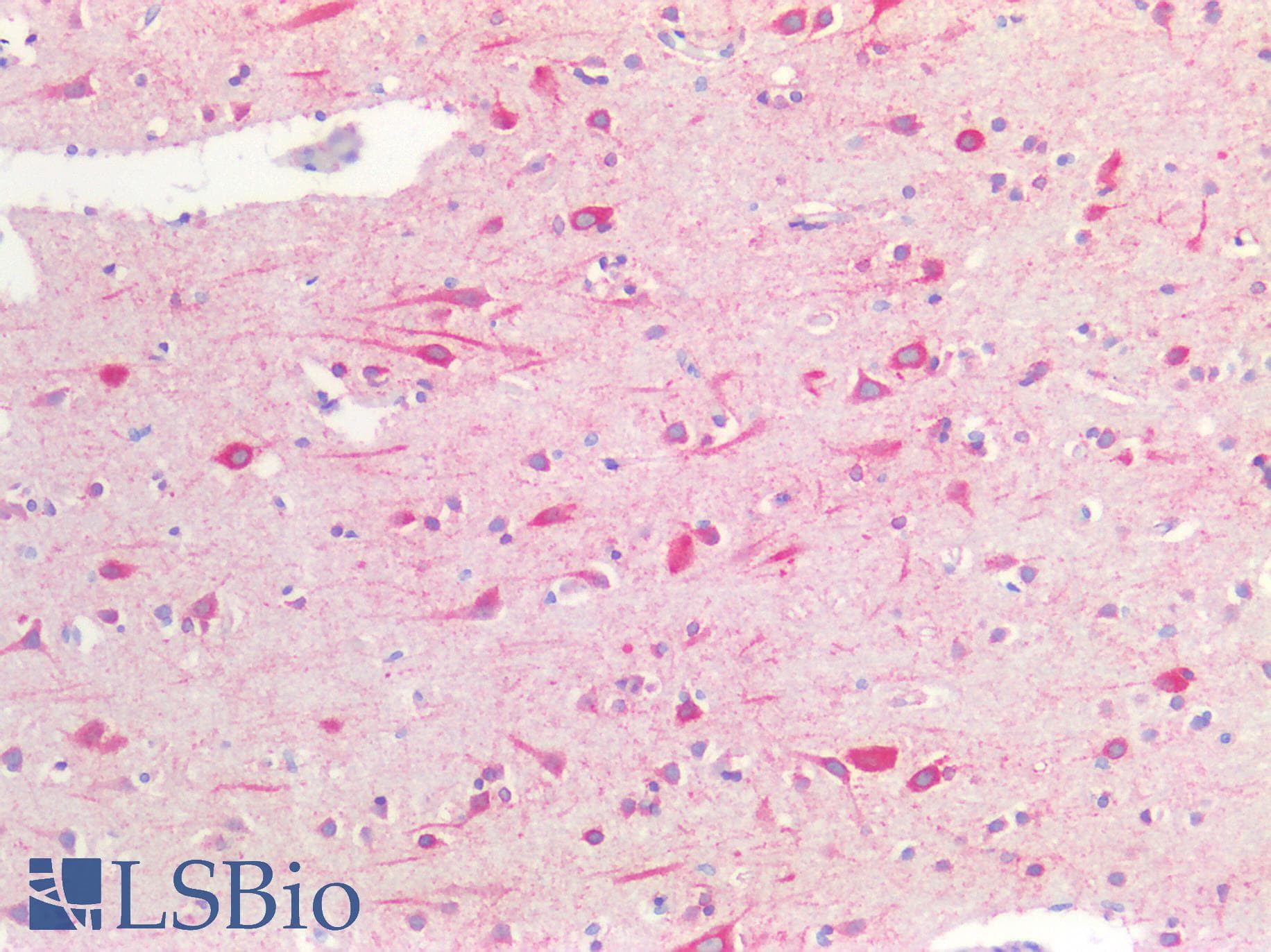 PathPlus™ CANX / Calnexin Antibody
