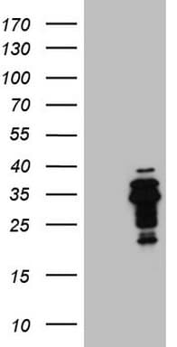 BP1 / DLX4 Antibody (clone OTI7H10)