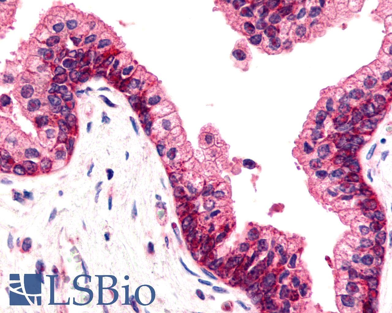 PathPlus™ ADGRG6 / GPR126 Antibody (C-Terminus)