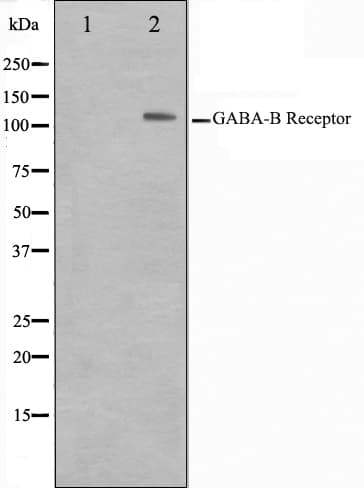 GABBR1 / GABA B Receptor 1 Antibody