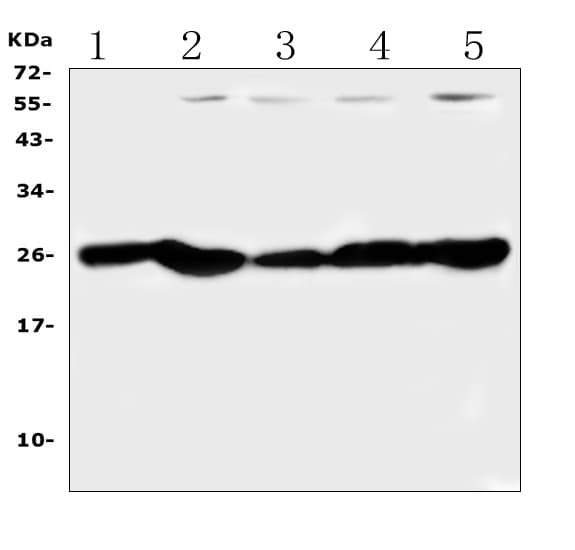 PGF / PLGF Antibody