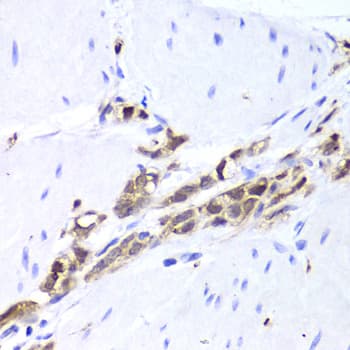 Polyclonal Rabbit anti-Human TPPP3 Antibody (IHC, WB)