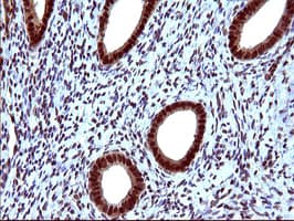 UPRT Antibody (clone OTI2D1)