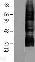 AQP9 / Aquaporin 9 Protein (Over-Expression Lysate Myc-DDK (Flag))