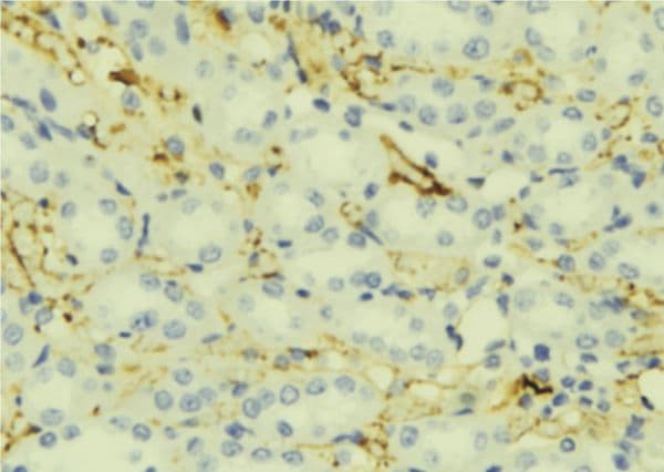Polyclonal Rabbit anti-Human APOC2 / Apolipoprotein C II Antibody (IHC, WB)