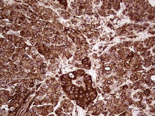 Monoclonal Mouse anti-Human IQGAP1 Antibody (clone OTI5F9, aa464-609, IHC, WB)