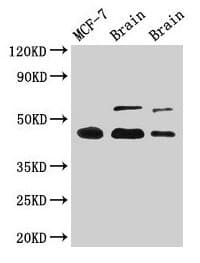 Polyclonal Rabbit anti-Human TP53 / p53 Antibody (aa2-393, IHC, WB)