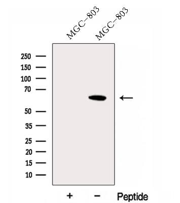 FBXW11 Antibody
