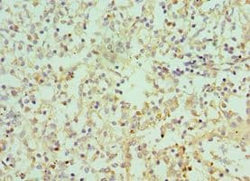 IHC-plus™ Polyclonal Rabbit anti-Human IL9 Antibody (aa19-144, IHC)