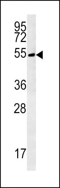 TRMT11 Antibody (aa303-332)