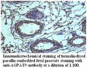 AGPAT9 / MAG1 Antibody (aa225-430)