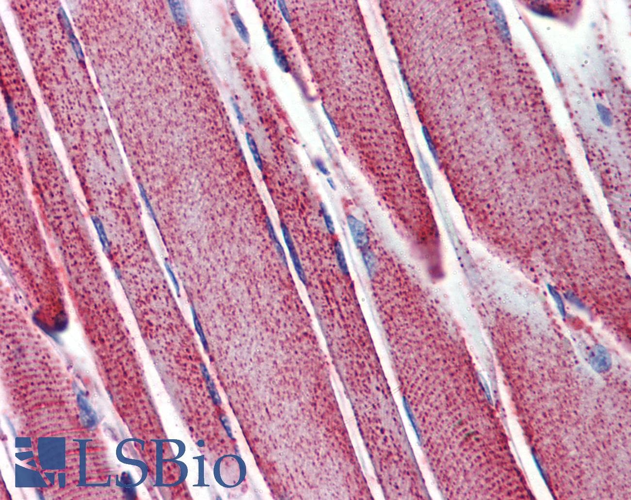 IHC-plus™ Polyclonal Rabbit anti-Rat SOD2 / Mn SOD Antibody (IHC, WB)