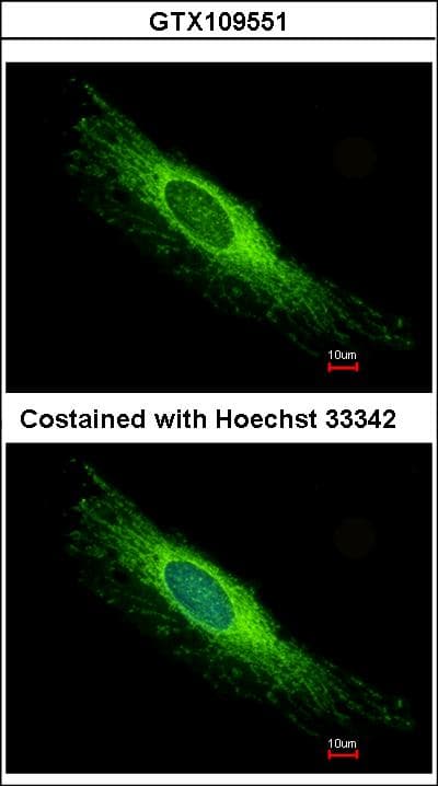 PEX26 Antibody (aa1-305)