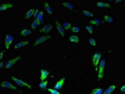 ATP6E / ATP6V1E1 Antibody