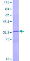 Human CCL18 / PARC Protein (Recombinant GST)