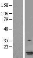 PYCARD / ASC / TMS1 Protein (Over-Expression Lysate Myc-DDK (Flag))