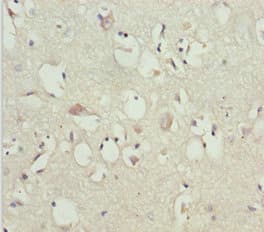 GAS2L1 Antibody