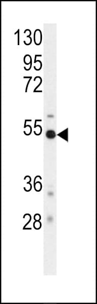 Polyclonal Rabbit anti-Human BACE1 / BACE Antibody (Ser498, WB)