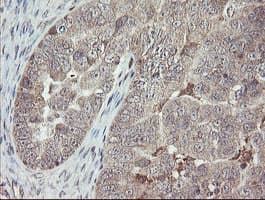 APP / Beta Amyloid Precursor Antibody (clone OTI4C9)